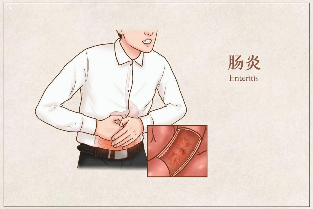 最新肠炎病科技产品引领健康未来之路