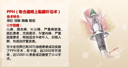 痔疮PPH手术价格与背后的暖心故事